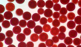 Astaxanthin powder